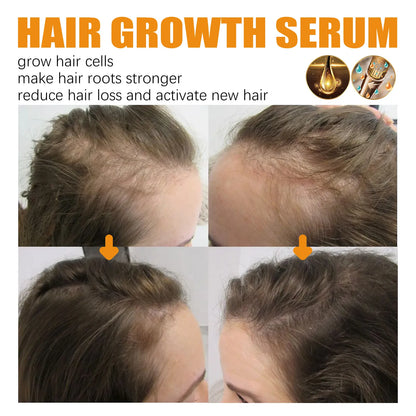 BY EELHOE Biotin Hair Growth & Repair Spray