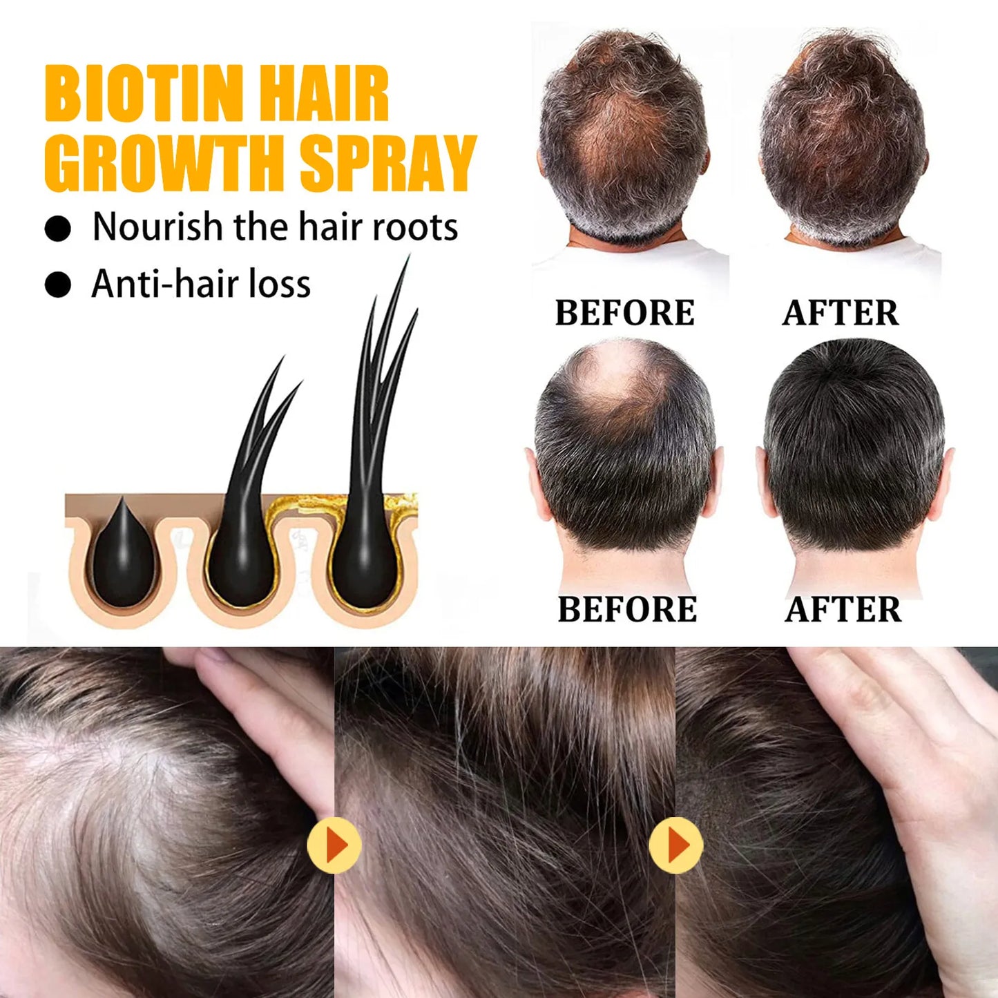 BY EELHOE Biotin Hair Growth & Repair Spray