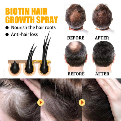 BY EELHOE Biotin Hair Growth & Repair Spray